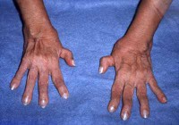 /album/galeria-de-fotos/artreu3-jpg/