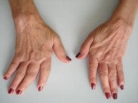 /album/galeria-de-fotos/moscomartrite-jpg/